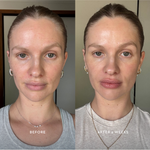 Official Mukti Bioactive Renewal Day Serum before and after six weeks portraits.