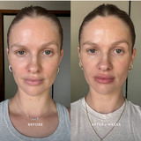 Official Mukti Bioactive Renewal Day Serum before and after six weeks portraits.