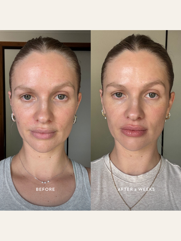 Official Mukti Bioactive Renewal Day Serum before and after six weeks portraits.