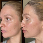 Official Mukti Bioactive Renewal Eye Crème before and after profile portraits.