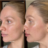 Official Mukti Bioactive Renewal Eye Crème before and after profile portraits.