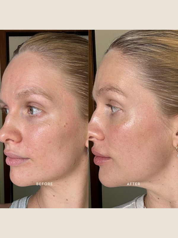Official Mukti Bioactive Renewal Eye Crème before and after profile portraits.
