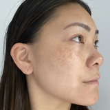 Close-up portrait after using Mukti Hyaluronic Marine Serum