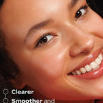 Model showing clearer smoother brighter skin after using Weleda Vitamin C Serum Booster Drops