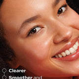 Model showing clearer smoother brighter skin after using Weleda Vitamin C Serum Booster Drops