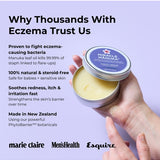 Sven's Island Miracle Manuka Flare Relief Balm held in hand with eczema benefits