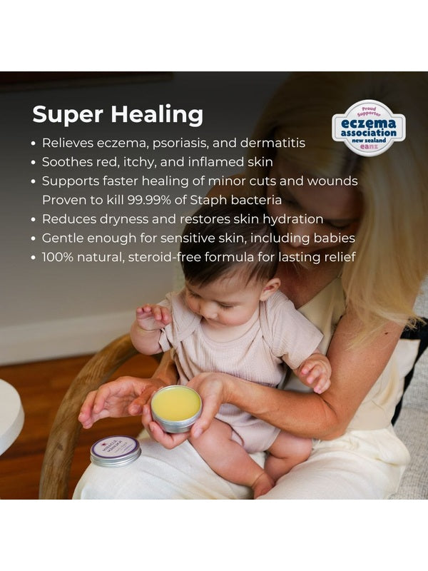 Mother applying Sven's Island Miracle Manuka Flare Relief Balm to her baby