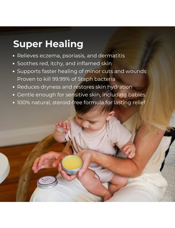 Mother holding a baby and Sven's Island Miracle Manuka Flare Relief Balm, with a Super Healing benefits list describing relief for eczema, psoriasis, dermatitis, dry skin and minor cuts.