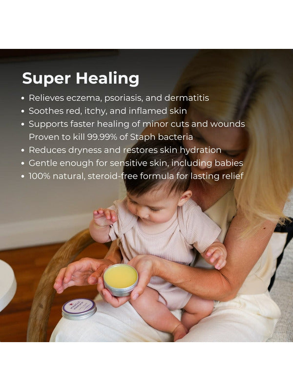 Mother holding a baby and Sven's Island Miracle Manuka Flare Relief Balm, with a Super Healing benefits list describing relief for eczema, psoriasis, dermatitis, dry skin and minor cuts.