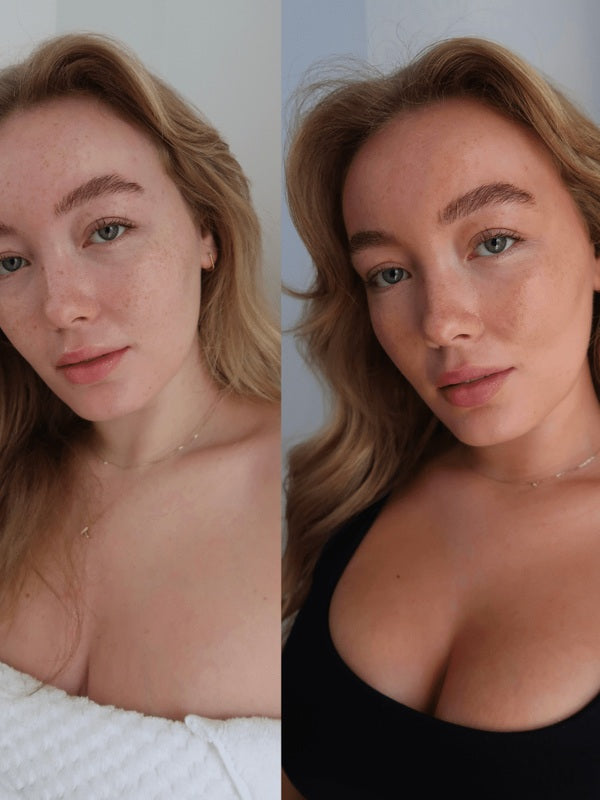 Face Tan Serum before and after complexion result
