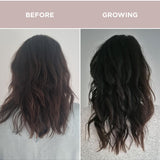 Before and after hair growth comparison using Tropeaka Hair Complex
