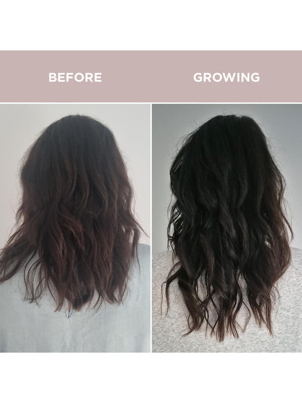 Before and after hair growth comparison using Tropeaka Hair Complex