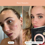 Before and after skin comparison using Tropeaka Skin Collagen