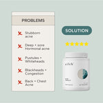 Acne concerns addressed by Zilch Acne Formula – Zilch Acne Formula 180 Tablets