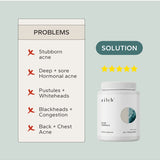 Acne concerns addressed by Zilch Acne Formula – Zilch Acne Formula 180 Tablets